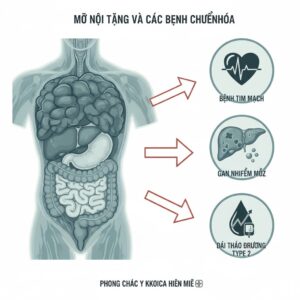 Mỡ nội tạng và nguy cơ bệnh chuyển hóa như tiểu đường, tim mạch